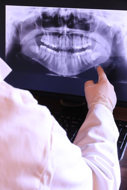Best Emergency Dental Care for Broken or Chipped Teeth in Interlaken, CA