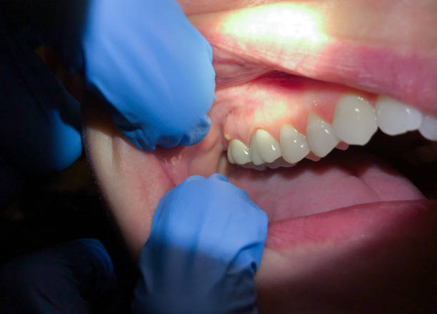 Best Same-Day Emergency Dental Services in Interlaken, CA