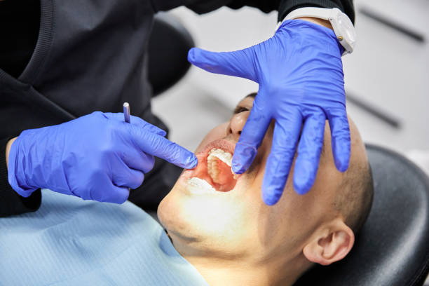 Best Emergency Tooth Extraction in Interlaken, CA